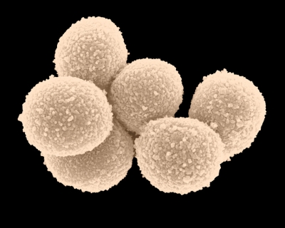 scanning electron micrograph showing a cluster of six round cells