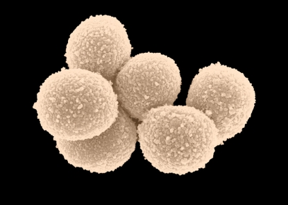 scanning electron micrograph showing a cluster of six round cells